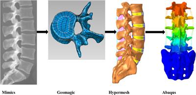 The impact of disc degeneration on the dynamic characteristics of the lumbar spine: a finite element analysis